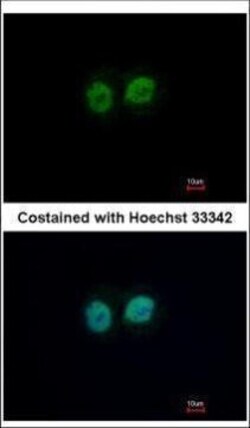 Invitrogen RCC2 Polyclonal Antibody 100 &mu;L; Unconjugated:Antibodies,