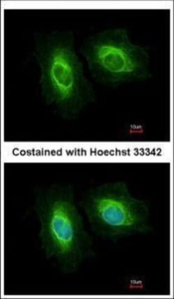 Invitrogen SASS6 Polyclonal Antibody 100 &mu;L; Unconjugated:Antibodies,