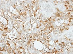 Invitrogen SASS6 Polyclonal Antibody 100 &mu;L; Unconjugated:Antibodies,