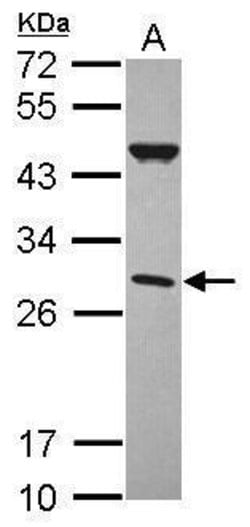 Invitrogen CFHR2 Polyclonal Antibody 100 &mu;L; Unconjugated:Antibodies,