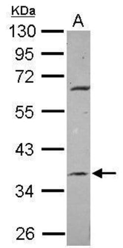 Invitrogen METTL2B Polyclonal Antibody 100 &mu;L; Unconjugated:Antibodies,
