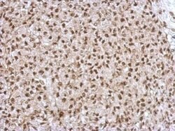 ZNF567 Polyclonal Antibody, Invitrogen 100 μL; Unconjugated:Antibodies,