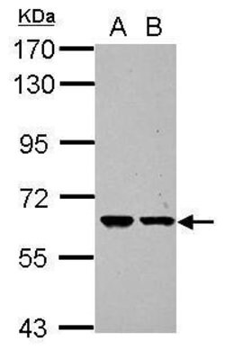 ZNF567 Polyclonal Antibody, Invitrogen 100 μL; Unconjugated:Antibodies,