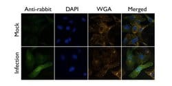 Invitrogen Influenza A PA Polyclonal Antibody 100 &mu;L | Buy Online | Invitrogen&trade; | Fisher Scientific