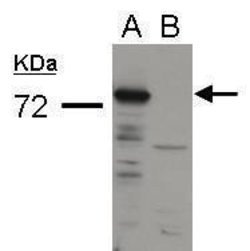 Invitrogen Influenza A PA Polyclonal Antibody 100 &mu;L | Buy Online | Invitrogen&trade; | Fisher Scientific