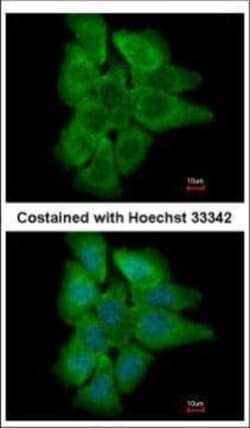 Invitrogen PHLPP2 Polyclonal Antibody 100 &mu;L; Unconjugated:Antibodies,