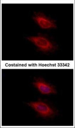 Invitrogen YARS2 Polyclonal Antibody 100 &mu;L; Unconjugated:Antibodies,