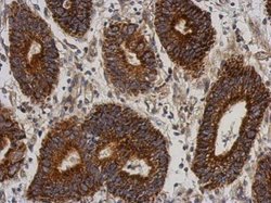 Invitrogen C21orf2 Polyclonal Antibody 100 μL; Unconjugated:Antibodies,