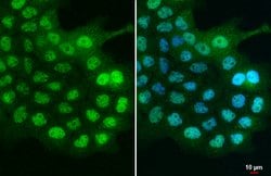 Invitrogen C21orf2 Polyclonal Antibody 100 μL; Unconjugated:Antibodies,