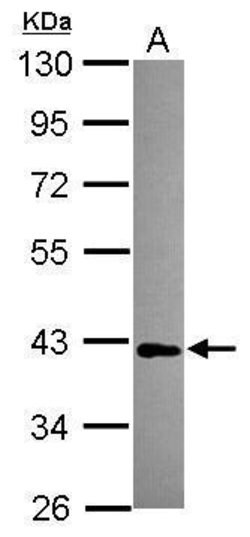 Invitrogen MAB21L1 Polyclonal Antibody 100 &mu;L; Unconjugated:Antibodies,