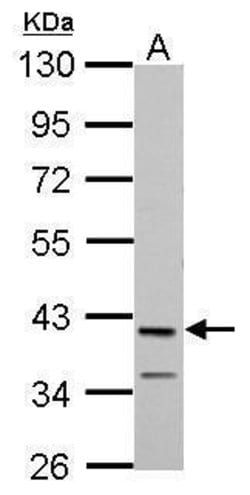 Invitrogen MAB21L1 Polyclonal Antibody 100 &mu;L; Unconjugated:Antibodies,