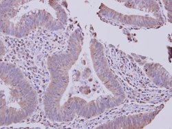 Invitrogen SLC22A18AS Polyclonal Antibody 100 &mu;L; Unconjugated:Antibodies,