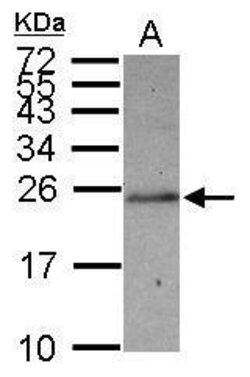Invitrogen SLC22A18AS Polyclonal Antibody 100 &mu;L; Unconjugated:Antibodies,