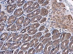 Invitrogen™ PTPRH Polyclonal Antibody