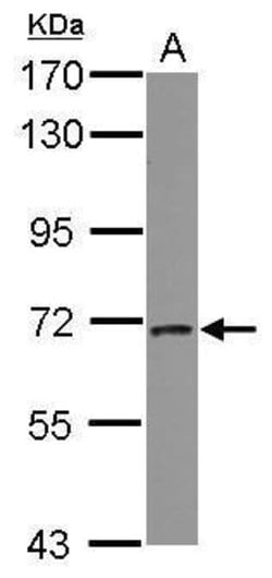 CALM Polyclonal Antibody:Antibodies, Polyclonal