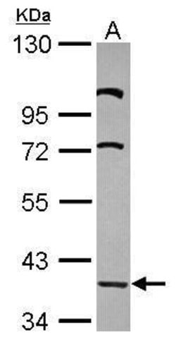 LDB2 Polyclonal Antibody:Antibodies, Polyclonal