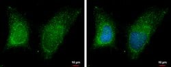 Invitrogen RAB11B Polyclonal Antibody 100 &mu;L; Unconjugated:Antibodies,