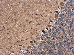 Invitrogen RAB11B Polyclonal Antibody 100 &mu;L; Unconjugated:Antibodies,