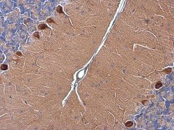 Invitrogen RAB11B Polyclonal Antibody 100 &mu;L; Unconjugated:Antibodies,