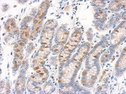 Invitrogen RAB11B Polyclonal Antibody 100 &mu;L; Unconjugated:Antibodies,