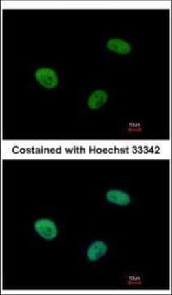 Invitrogen UBE3C Polyclonal Antibody 100 &mu;L; Unconjugated:Antibodies,