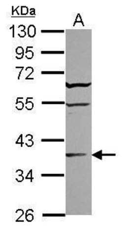 Invitrogen ST6GALNAC2 Polyclonal Antibody 100 &mu;L; Unconjugated:Antibodies,