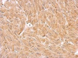 Invitrogen Septin-8 Polyclonal Antibody 100 &mu;L | Buy Online | Invitrogen&trade; | Fisher Scientific