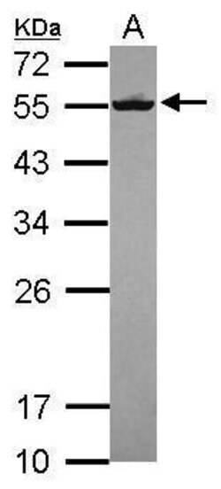 Invitrogen Septin-8 Polyclonal Antibody 100 &mu;L | Buy Online | Invitrogen&trade; | Fisher Scientific