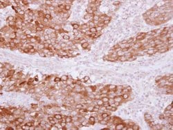 Invitrogen PITPNB Polyclonal Antibody 100 &mu;L; Unconjugated:Antibodies,