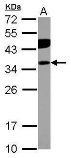 Invitrogen PITPNB Polyclonal Antibody 100 &mu;L; Unconjugated:Antibodies,