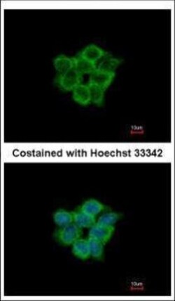 Invitrogen ACOT11 Polyclonal Antibody 100 μL; Unconjugated:Antibodies,