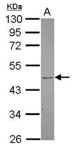Invitrogen TBL2 Polyclonal Antibody 100 &mu;L | Buy Online | Invitrogen&trade; | Fisher Scientific