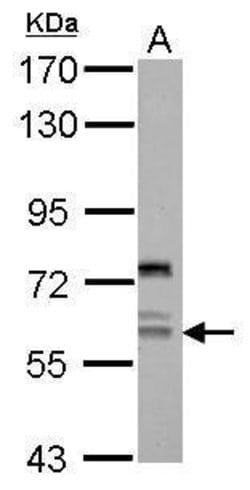 Invitrogen REPIN1 Polyclonal Antibody 100 &mu;L | Buy Online | Invitrogen&trade; | Fisher Scientific