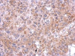 Invitrogen SPOCK3 Polyclonal Antibody 100 &mu;L | Buy Online | Invitrogen&trade; | Fisher Scientific