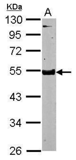 Invitrogen SPOCK3 Polyclonal Antibody 100 &mu;L | Buy Online | Invitrogen&trade; | Fisher Scientific