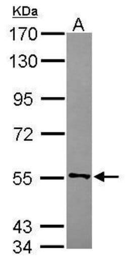 Invitrogen CYB5R4 Polyclonal Antibody 100 &mu;L | Buy Online | Invitrogen&trade; | Fisher Scientific