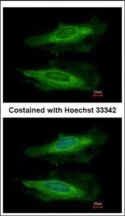 Invitrogen HECA Polyclonal Antibody 100 μL; Unconjugated:Antibodies,