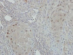 NAT10 Polyclonal Antibody, Invitrogen 100 &mu;L; Unconjugated:Antibodies,
