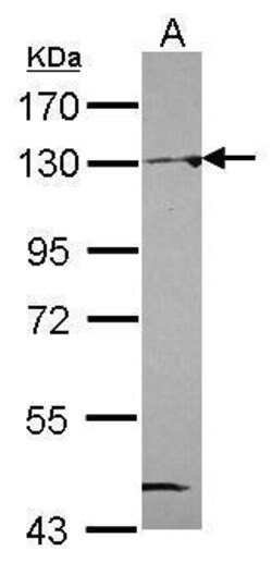 NAT10 Polyclonal Antibody, Invitrogen 100 &mu;L; Unconjugated:Antibodies,