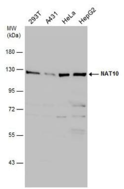 Invitrogen NAT10 Polyclonal Antibody 100 &mu;L | Buy Online | Invitrogen&trade; | Fisher Scientific