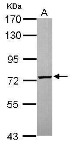 Invitrogen PGM2 Polyclonal Antibody 100 &mu;L; Unconjugated:Antibodies,