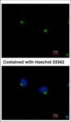 Invitrogen IFT122 Polyclonal Antibody 100 &mu;L | Buy Online | Invitrogen&trade; | Fisher Scientific