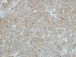 Invitrogen PCDHGB5 Polyclonal Antibody 100 &mu;L | Buy Online | Invitrogen&trade; | Fisher Scientific