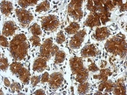 Invitrogen TSCOT Polyclonal Antibody 100 &mu;L | Buy Online | Invitrogen&trade; | Fisher Scientific