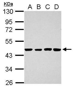Invitrogen TSCOT Polyclonal Antibody 100 &mu;L | Buy Online | Invitrogen&trade; | Fisher Scientific
