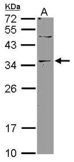 Invitrogen DNASE2B Polyclonal Antibody 100 μL; Unconjugated:Antibodies,