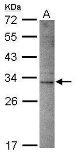 Invitrogen DNASE2B Polyclonal Antibody 100 &mu;L; Unconjugated:Antibodies,