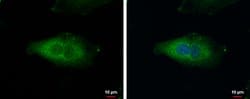 Invitrogen NDUFAF5 Polyclonal Antibody 100 &mu;L; Unconjugated:Antibodies,