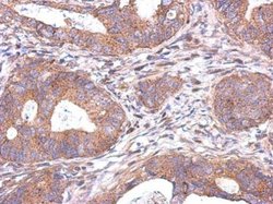 Invitrogen NDUFAF5 Polyclonal Antibody 100 &mu;L; Unconjugated:Antibodies,