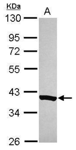 Invitrogen NDUFAF5 Polyclonal Antibody 100 &mu;L; Unconjugated:Antibodies,